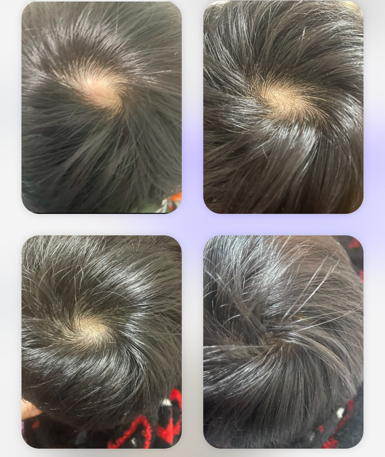 Revive Hair Serum 50ml