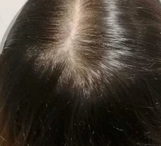 Revive Hair Serum 50ml