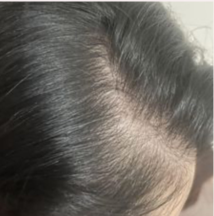 Revive Hair Serum 50ml