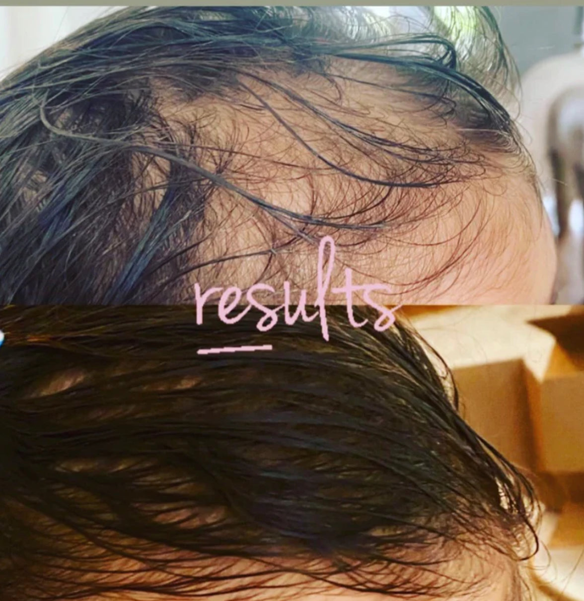 Revive Hair Serum 50ml