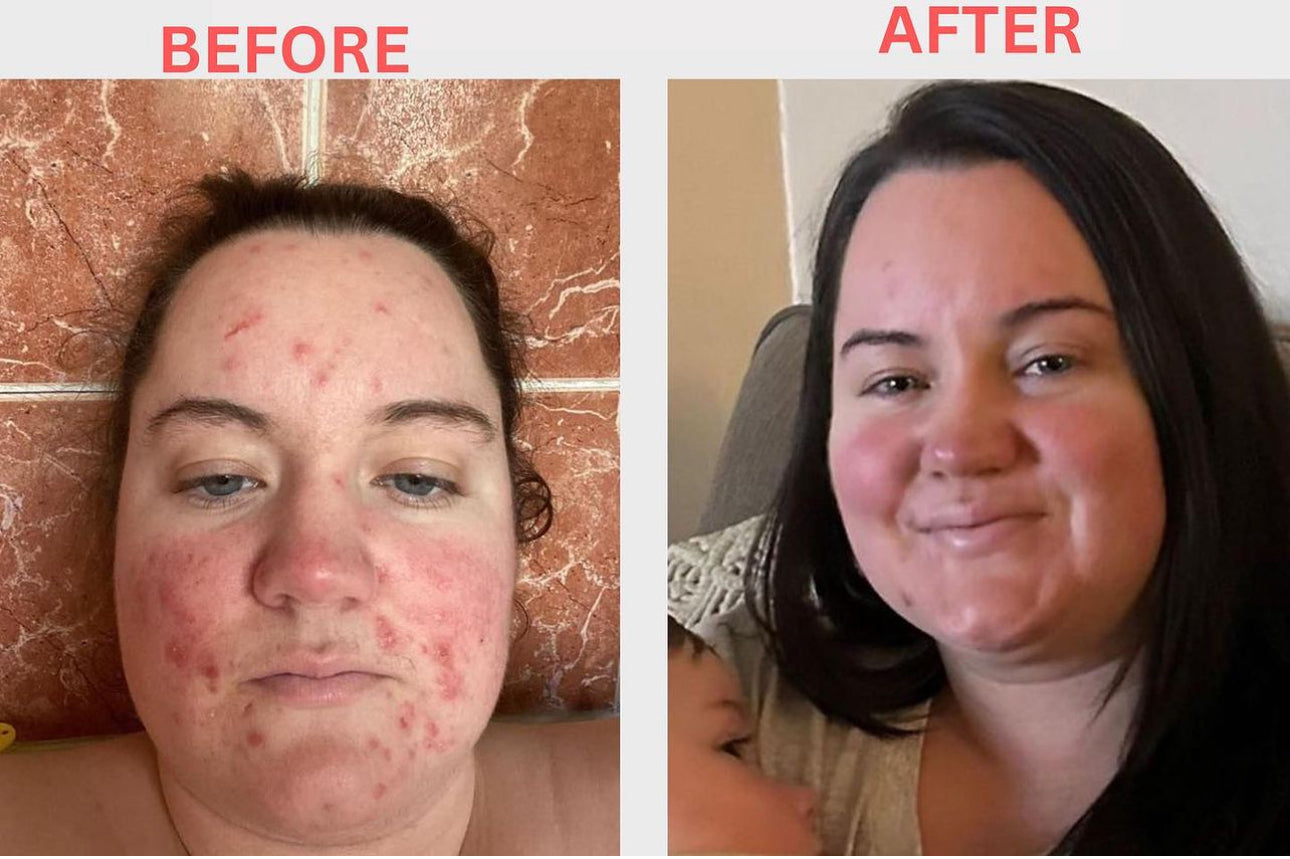 Miracle Face Serum 50ml