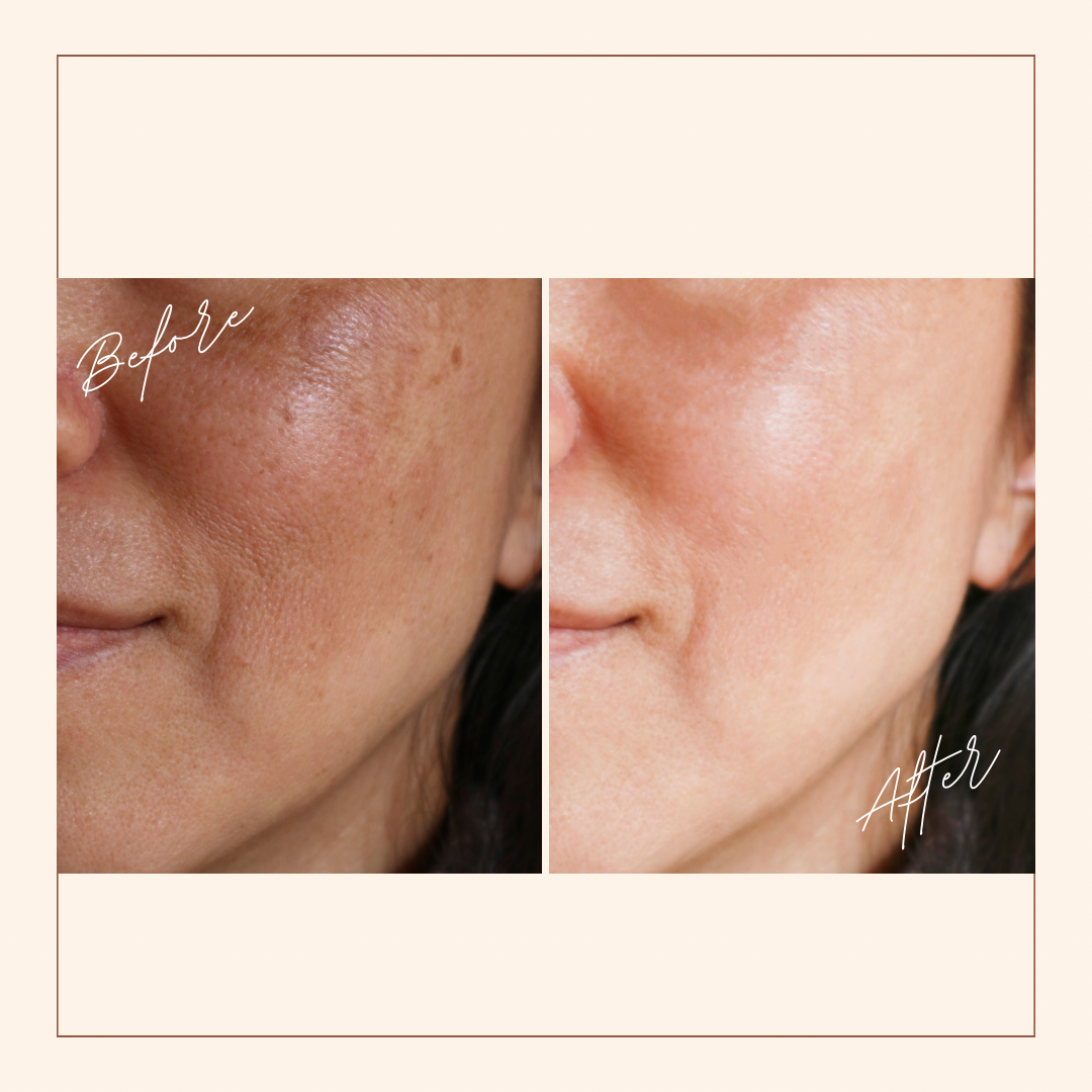 Miracle Face Serum 50ml