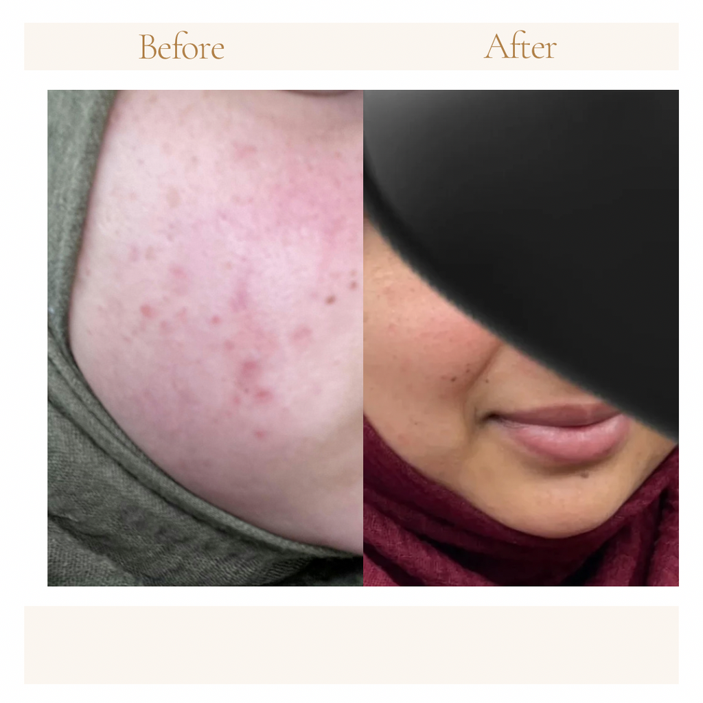 Miracle Face Serum 50ml